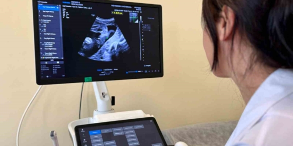 Yüksek riskli gebeliklere perinatoloji uzman takibi
