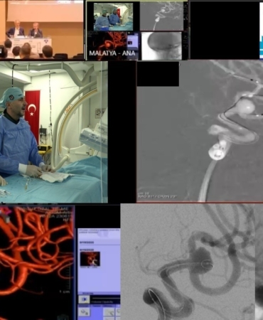 kitalari-birlestiren-cerrahi-basari-malatyadan-uzman-ekipten-canli-anjiyo-ve-cifte-operasyon-vhldNwUe.jpg