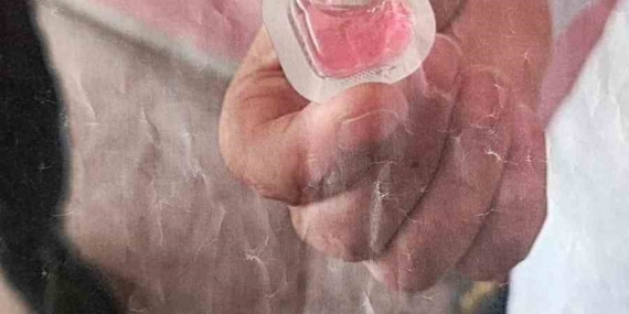 Bağlar’da Havadan Kuduz Aşısı Uygulaması ve Vatandaş Bildirimi