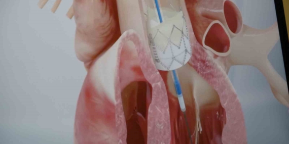 Gençlerde Ani Ölümler ve Kalp Krizleri: Genetik Faktörler Ön Planda